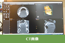 CT画像